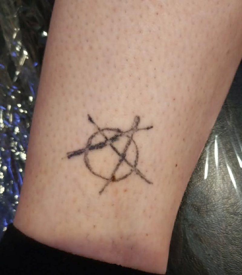 A faded black outline of a circled symbol on a lower leg, before cover-up